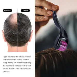 Derma Roller_2