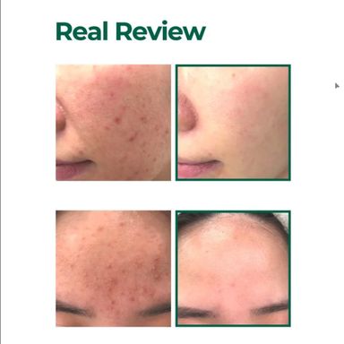 SOMEBYMI AHA.BHA.PHA 30 Days Miracle Starter Kit_1