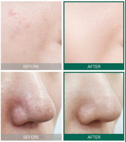 SOMEBYMI AHA.BHA.PHA 30 Days Miracle Starter Kit
