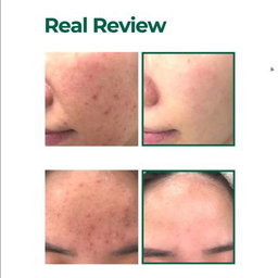 SOMEBYMI AHA.BHA.PHA 30 Days Miracle Serum 50ml