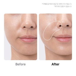 MEDICUBE Beauty device AGE R BOOSTER PRO EX PINK
