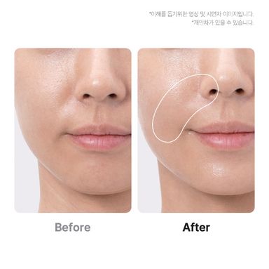 MEDICUBE Beauty device AGE R BOOSTER PRO EX PINK_2