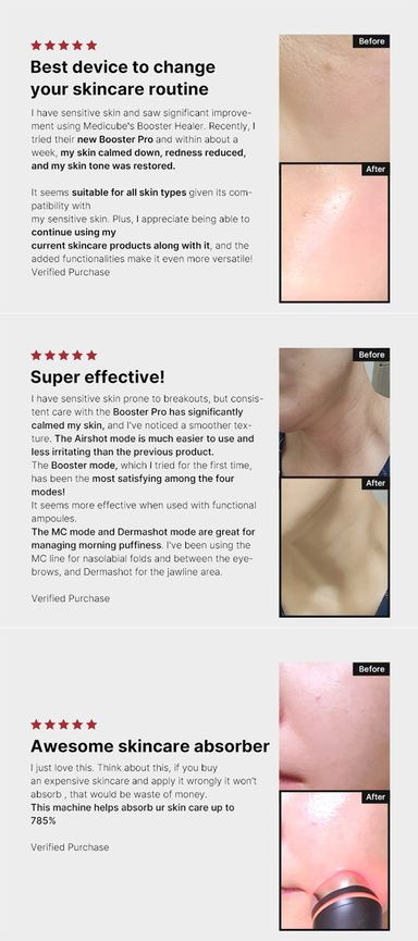MEDICUBE Beauty device AGE R BOOSTER PRO EX PINK_3
