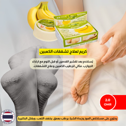 كريم الموز وزبدة الشيا لتنعيم اللأقدام والمفاصل الخشنة الحجم الصغير  
  Banana Heel Cream Chivaviti