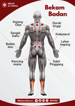 Bekam Badan