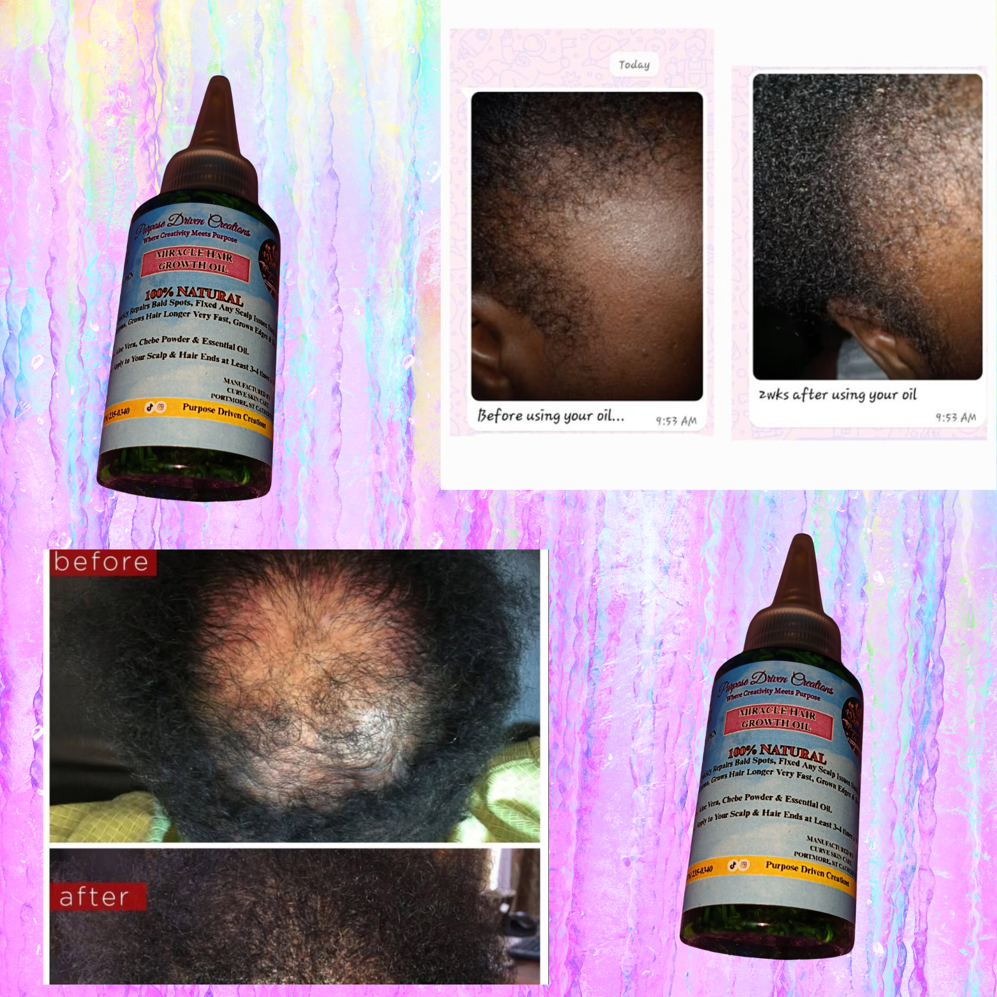 MIRACLE HAIR GROWTH OIL_0