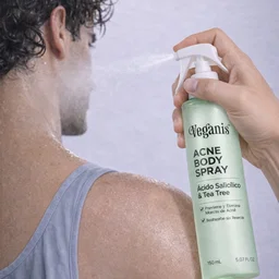 Acné Spray Corporal