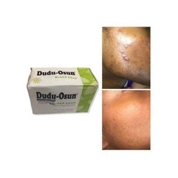 Dudu-Osun Dudu-Osun Black Soap - 150 Grams