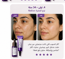 Some By Mi Retinol Kit/ شد البشره 