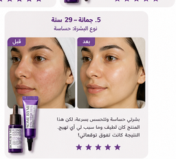 Some By Mi Retinol Kit/ شد البشره 