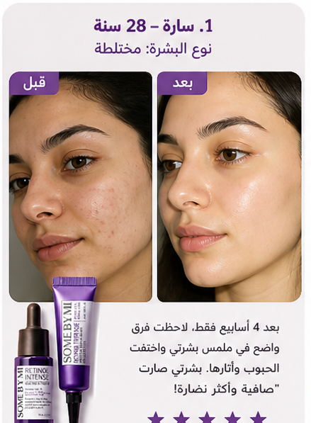 Some By Mi Retinol Kit/ شد البشره _5