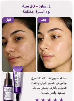 Some By Mi Retinol Kit/ شد البشره 