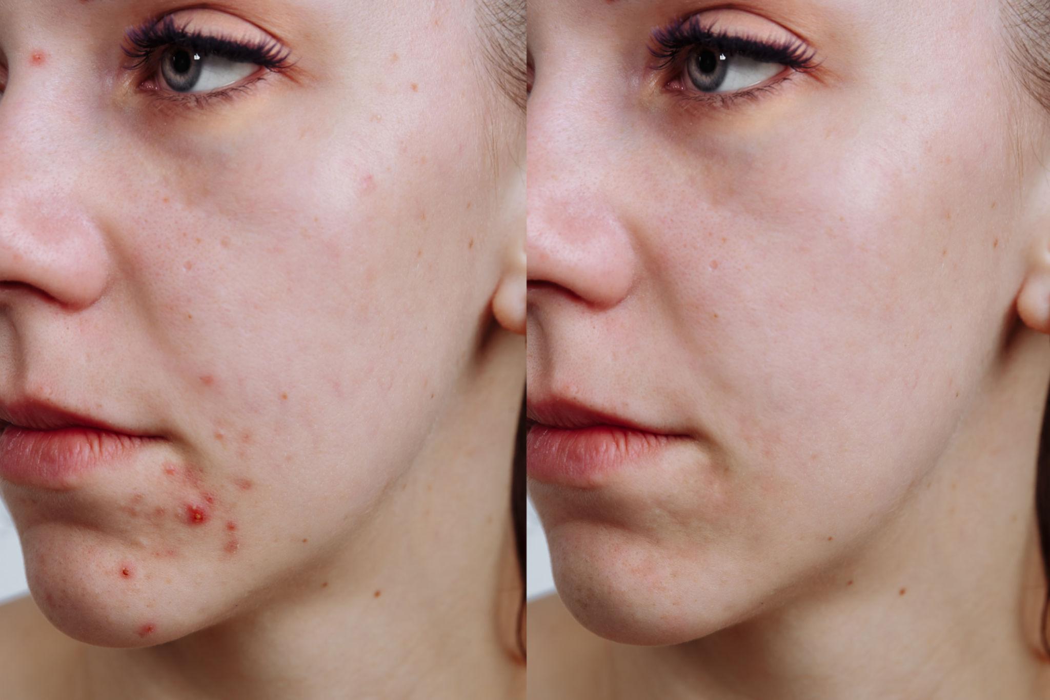 Anua Heartleaf Ampoule_6