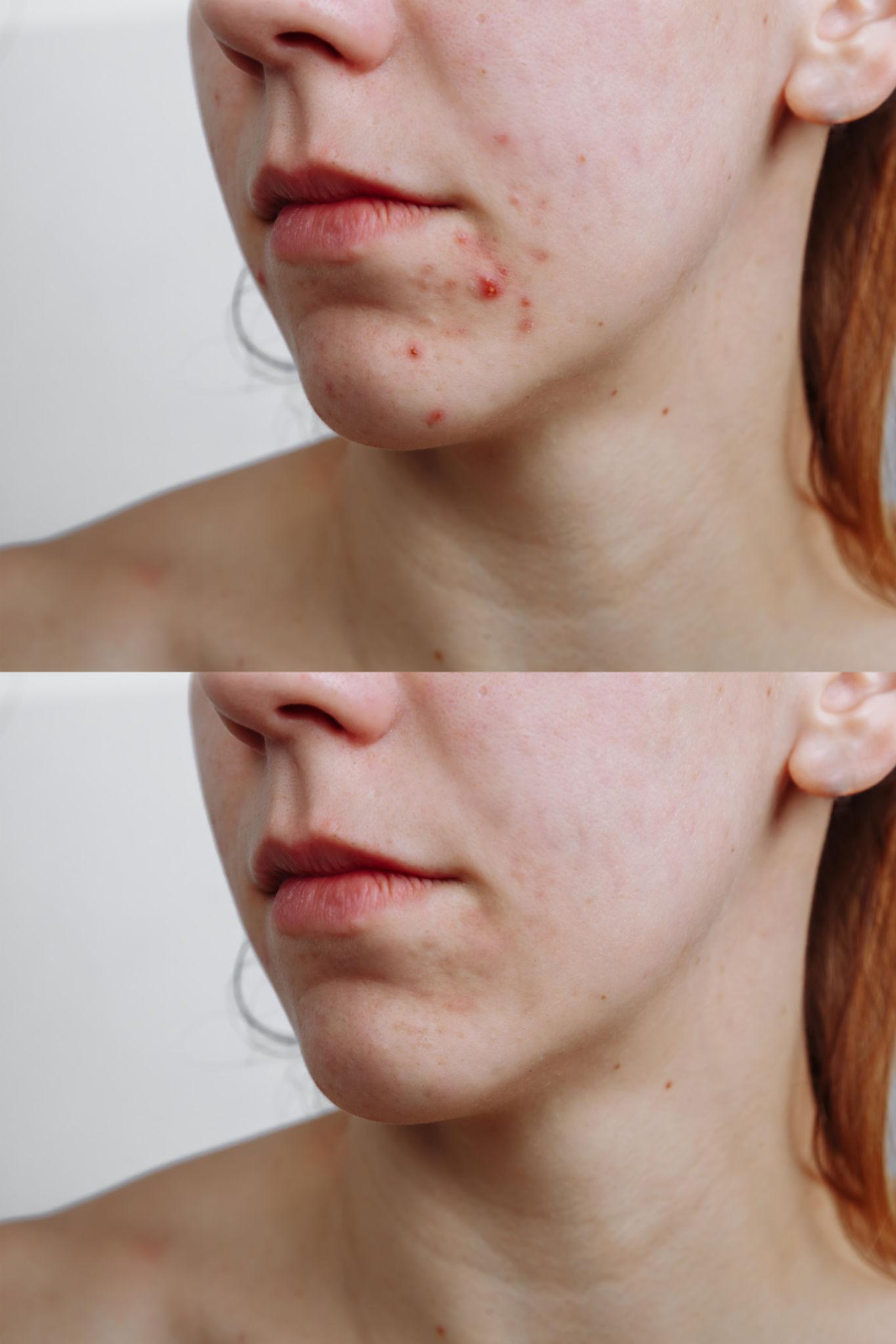 Anua Heartleaf Ampoule_2