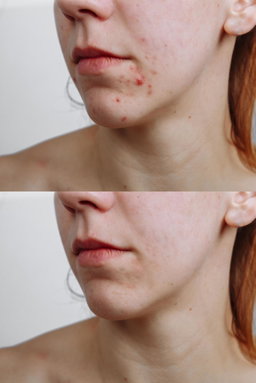 Anua Heartleaf Ampoule