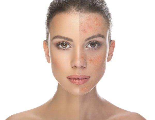 Anua Heartleaf Ampoule_8