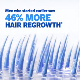 Rogaine -  5% Minoxidil for Men & Women Foam
