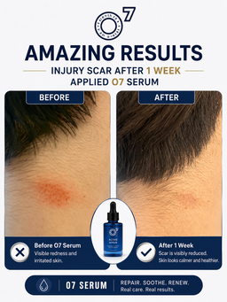 O7 Ozonated Oil Serum - Normal