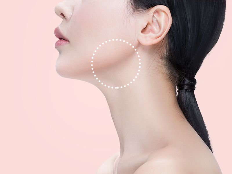 Jawtox / Masseter Tox