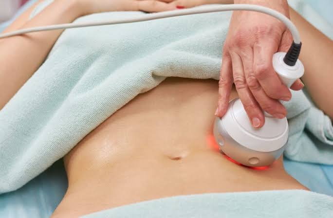 Radio Frequency (RF) Treatment