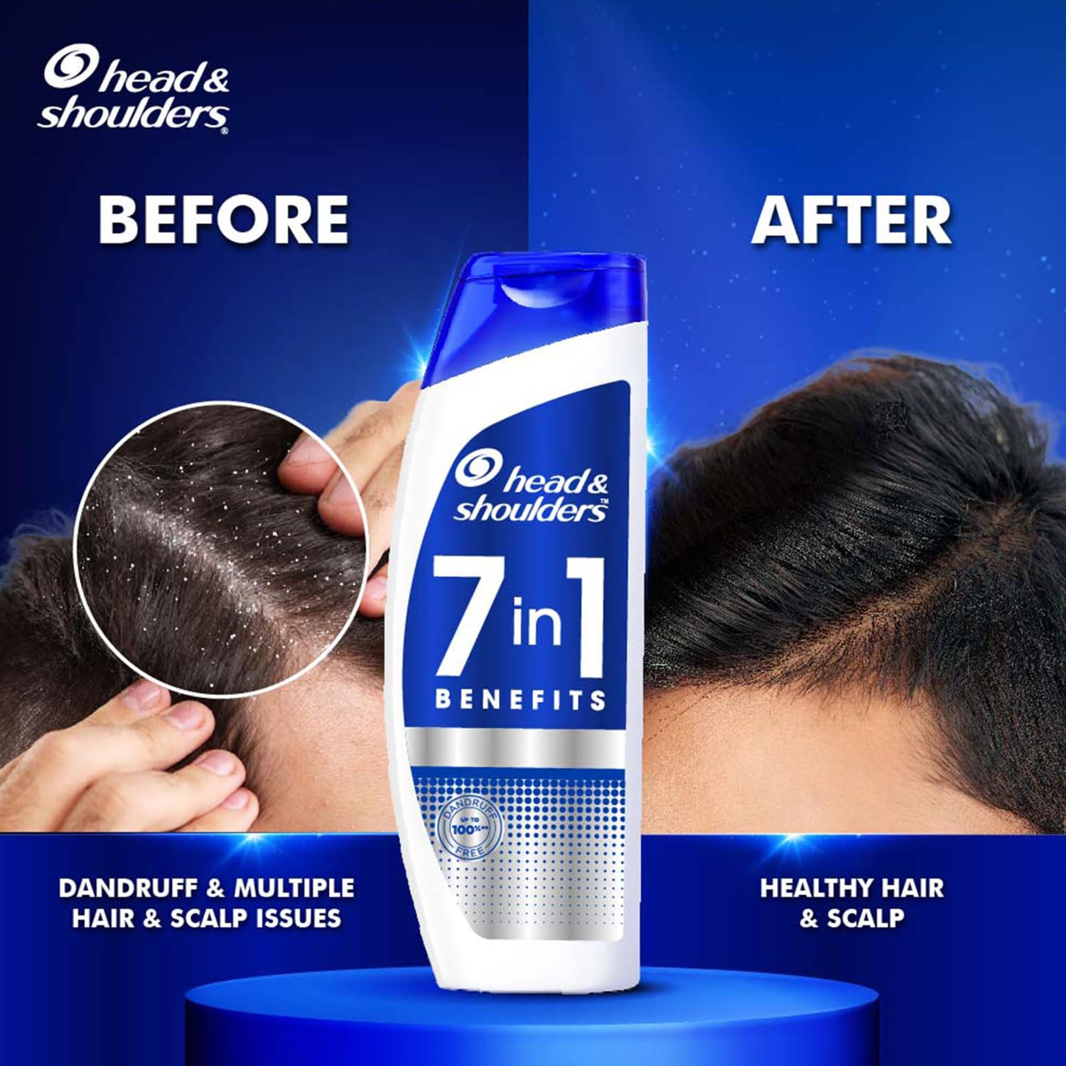 Head & Shoulders | 7 in1 | Anti-dandruff Shampoo _6