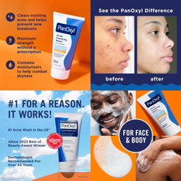 Panoxyl cleanser travel size 28g