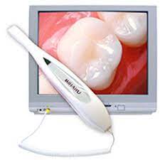 Camara Intraoral