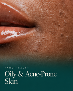 Oily & Acne Prone Skin