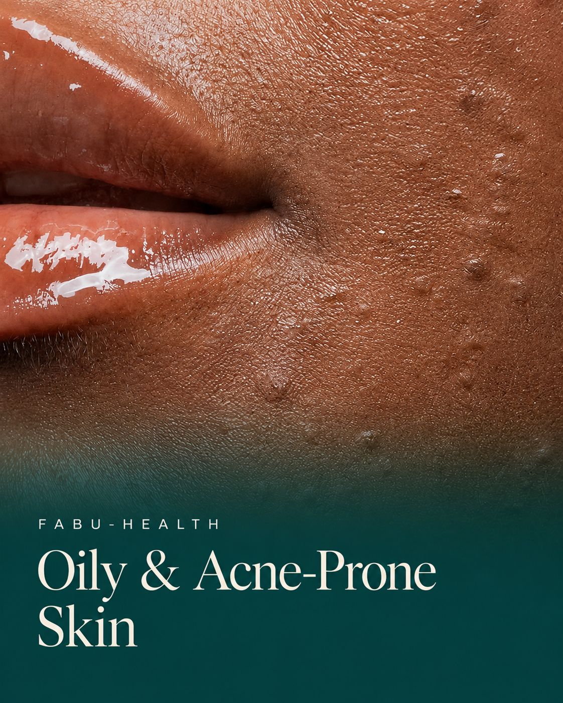 Oily & Acne Prone Skin_0