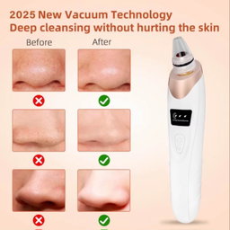 EVERGLOW™ – ASPIRATEUR DE POINTS NOIRS & NETTOYEUR DE PORES