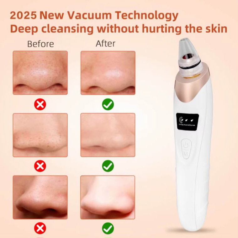 EVERGLOW™ – ASPIRATEUR DE POINTS NOIRS & NETTOYEUR DE PORES_2