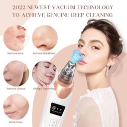 EVERGLOW™ – ASPIRATEUR DE POINTS NOIRS & NETTOYEUR DE PORES