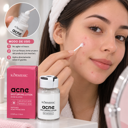 ✨🩷 Loción Secante para Granitos – KORMESIC 🩷✨