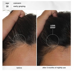 K18- FutureIQ Hair Longevity Serum for Graying,Thinning, & Scalp Aging