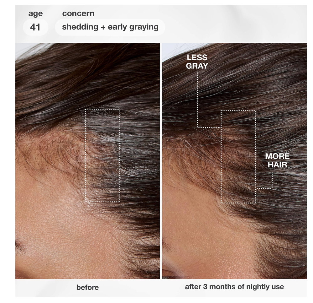 K18- FutureIQ Hair Longevity Serum for Graying,Thinning, & Scalp Aging_4