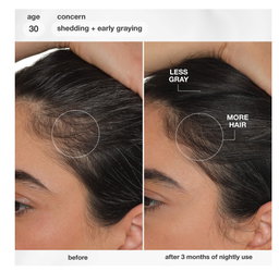 K18- FutureIQ Hair Longevity Serum for Graying,Thinning, & Scalp Aging