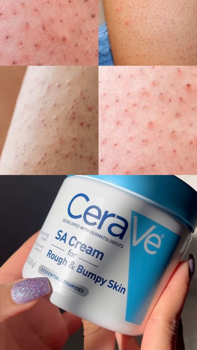 CeraVe SA Cream for Rough & Bumpy Skin