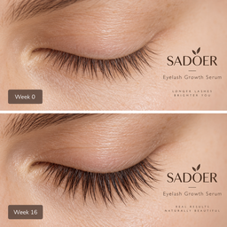 Serum para pestañas SADOER 👁