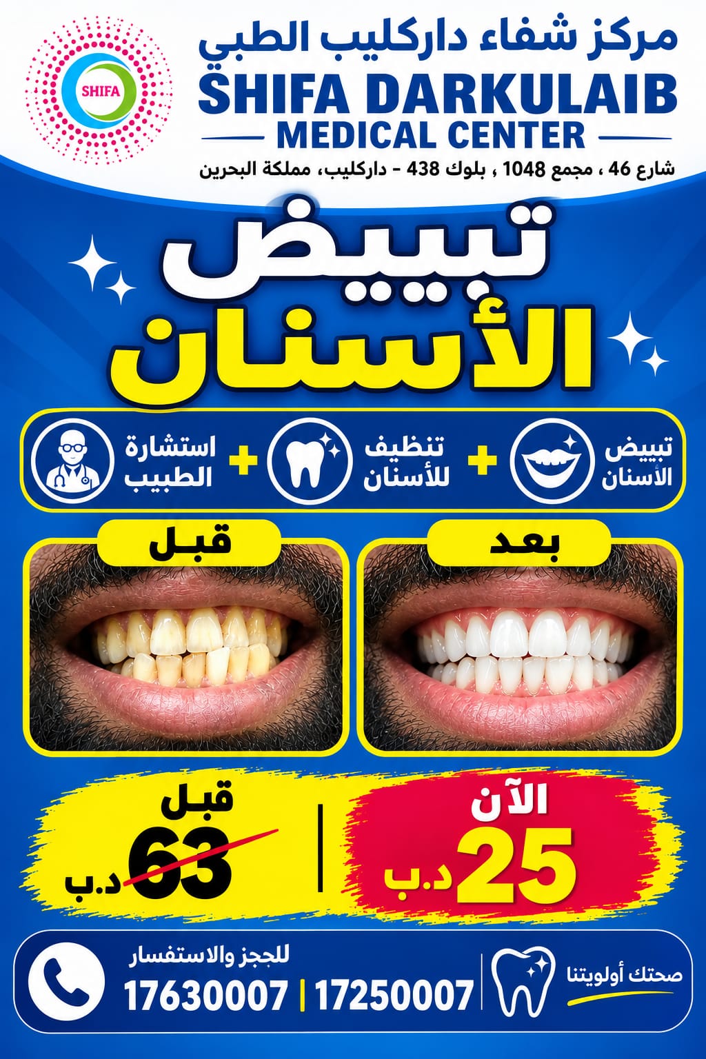 Teeth Whitening Package | باقة تبييض الأسنان_1