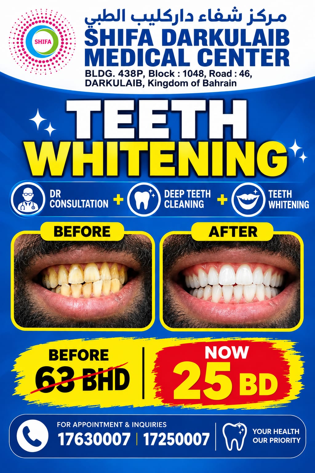 Teeth Whitening Package | باقة تبييض الأسنان_0