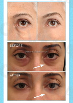 Crema facial