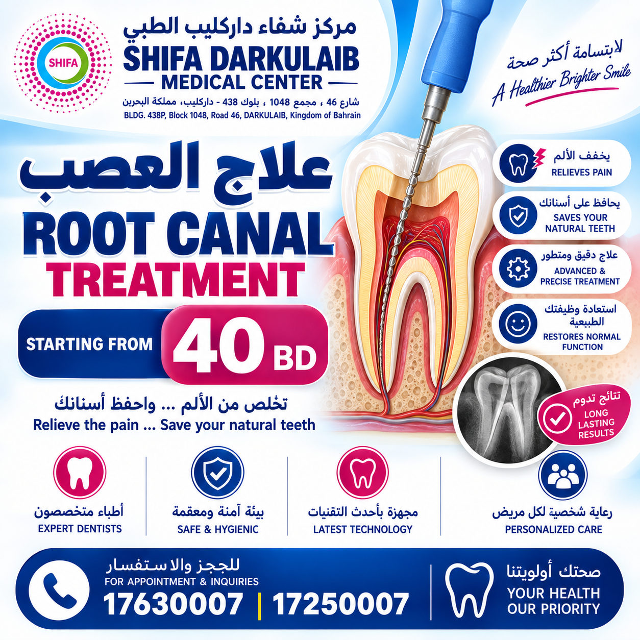 Root Canal Treatment | علاج العصب_0