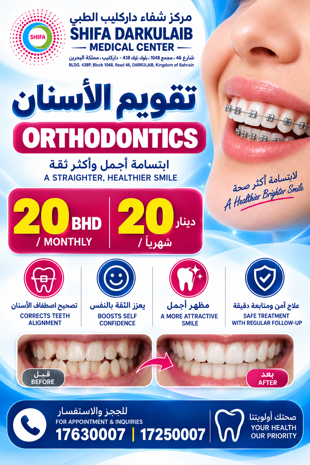 Orthodontic Braces – Monthly Plan | تقويم الأسنان – خطة شهرية_0