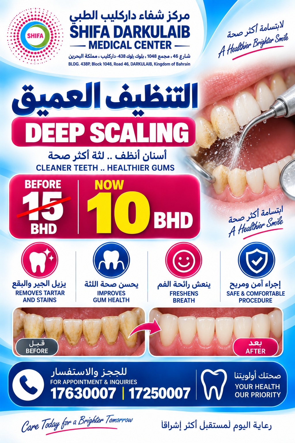 Deep Scaling | التنظيف العميق للأسنان
