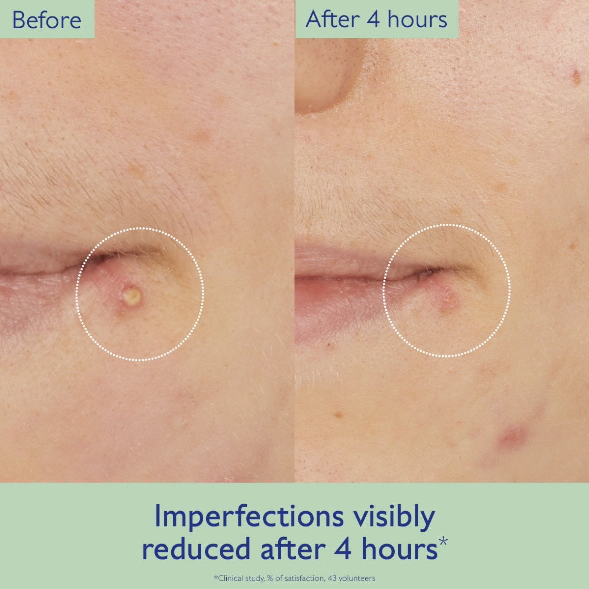 Caudalie Vinopure Spot Solution with Salicylic Acid_1