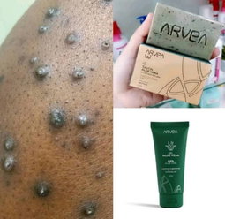 Savon Aloe vera