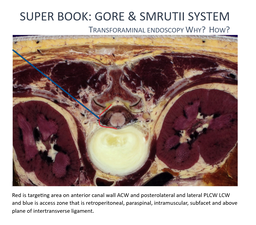 super book on transforaminal endoscopy pw protecetd 