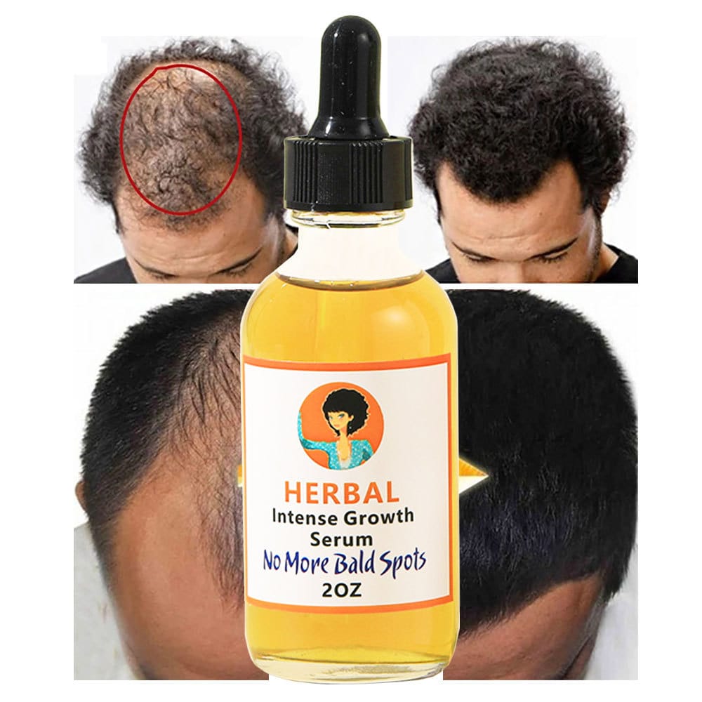 ANTI BALD SERUM