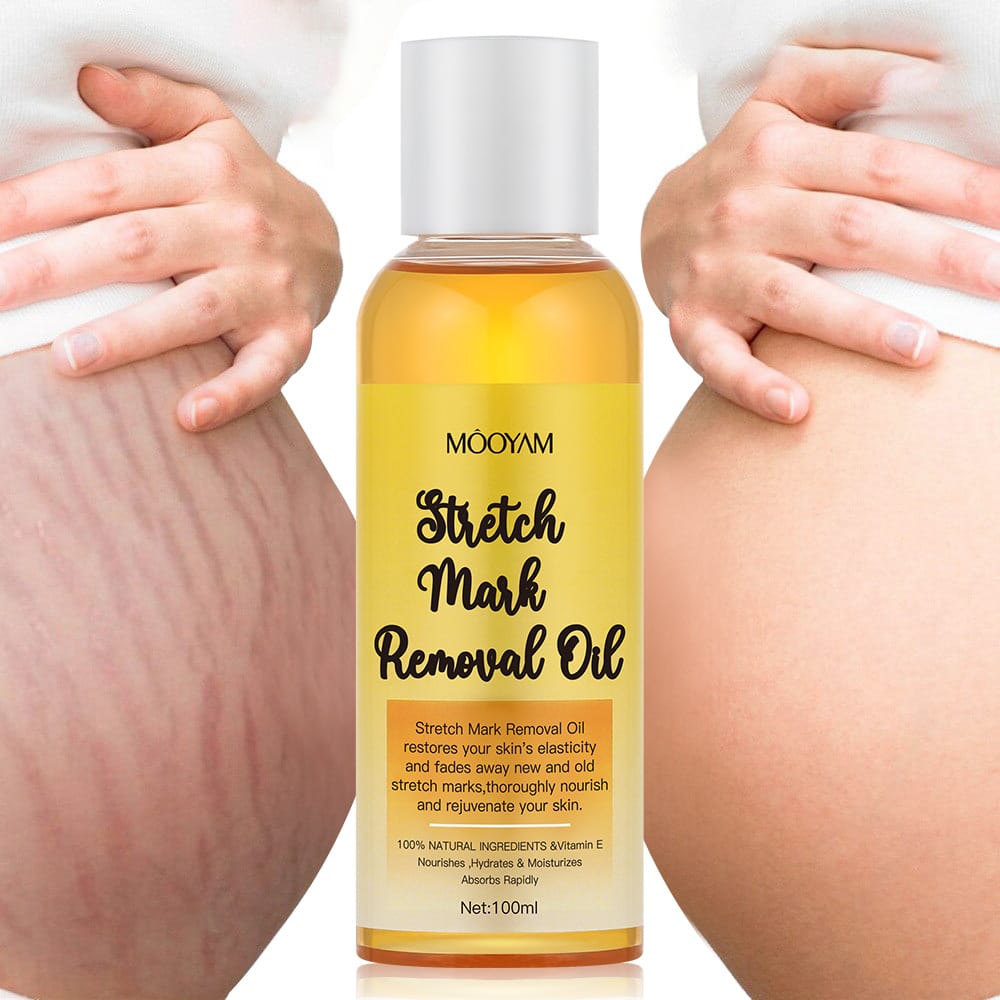 MOOYAM STRETCH MARK REMOVAL OIL
