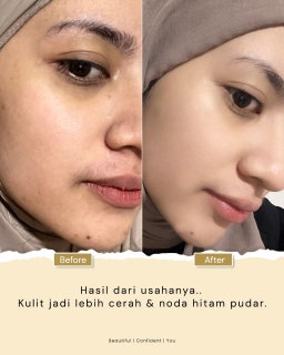 FACIAL SERUM B ERL COSMETIC